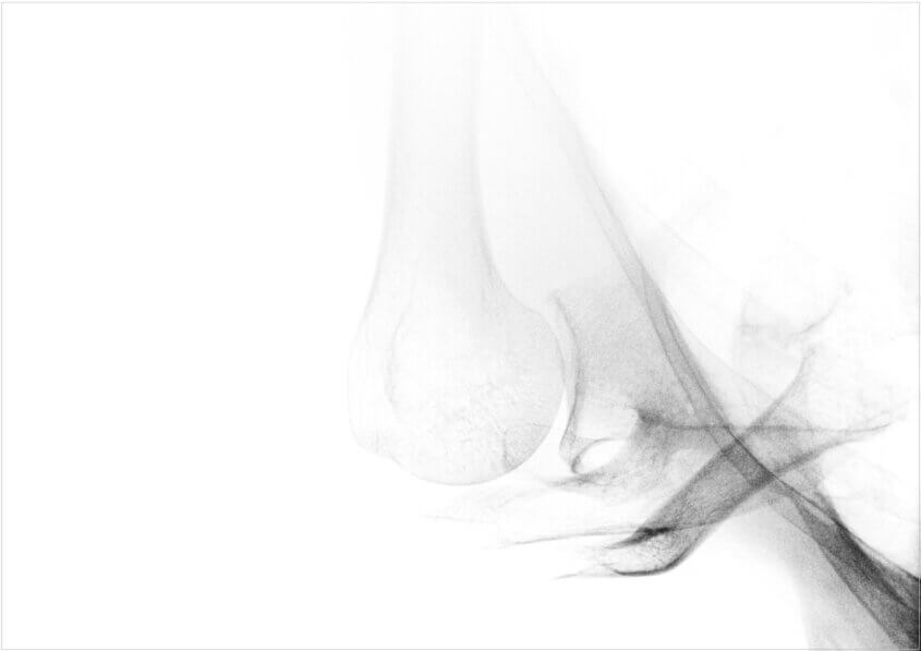 rachela abbate 110-Beyond-Pharmakon-mit-Rand-©Rachela-Abbate-copie-2-845x597 beyond pharmakon  